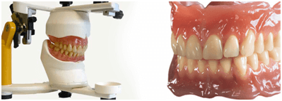 dentures-treatment-mallapur